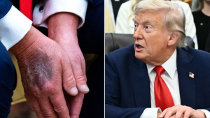 trumpkayboldumuhastalandiiddiasiabdyikaristirdibaskanaulasilamiyor17565507968182jpg-Z1J52NMl7ke0W35VMrxMJA